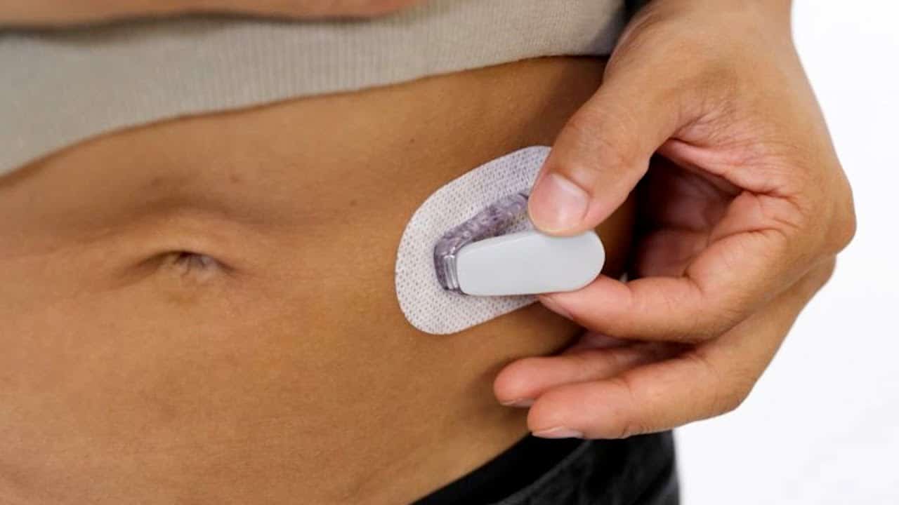 Using Mastisol Liquid Adhesive for Diabetic Patches AdhesiveSecure